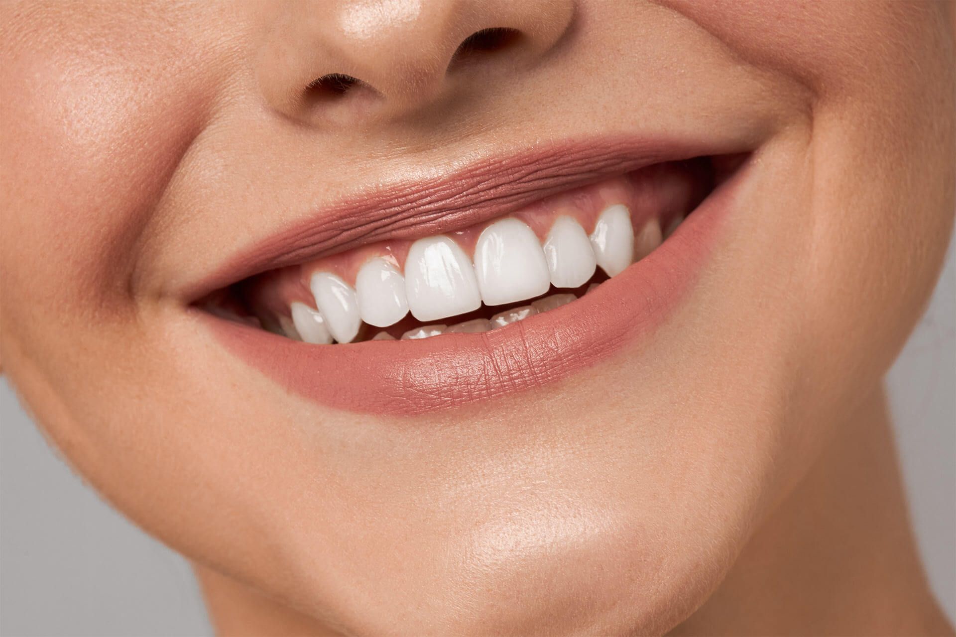 Teeth Whitening