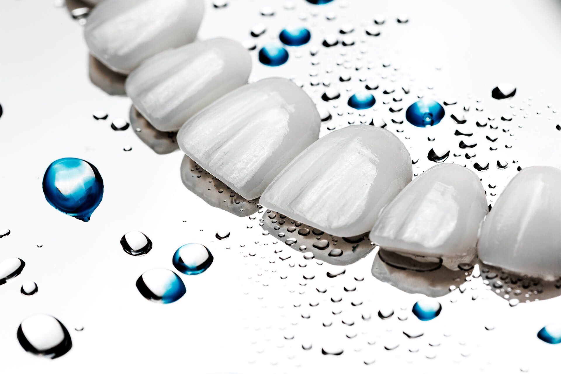 Veneers and Laminates